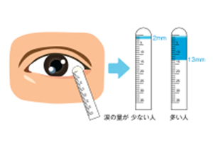 シルマー検査