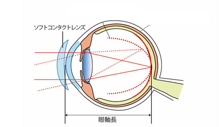 近視抑制のしくみ